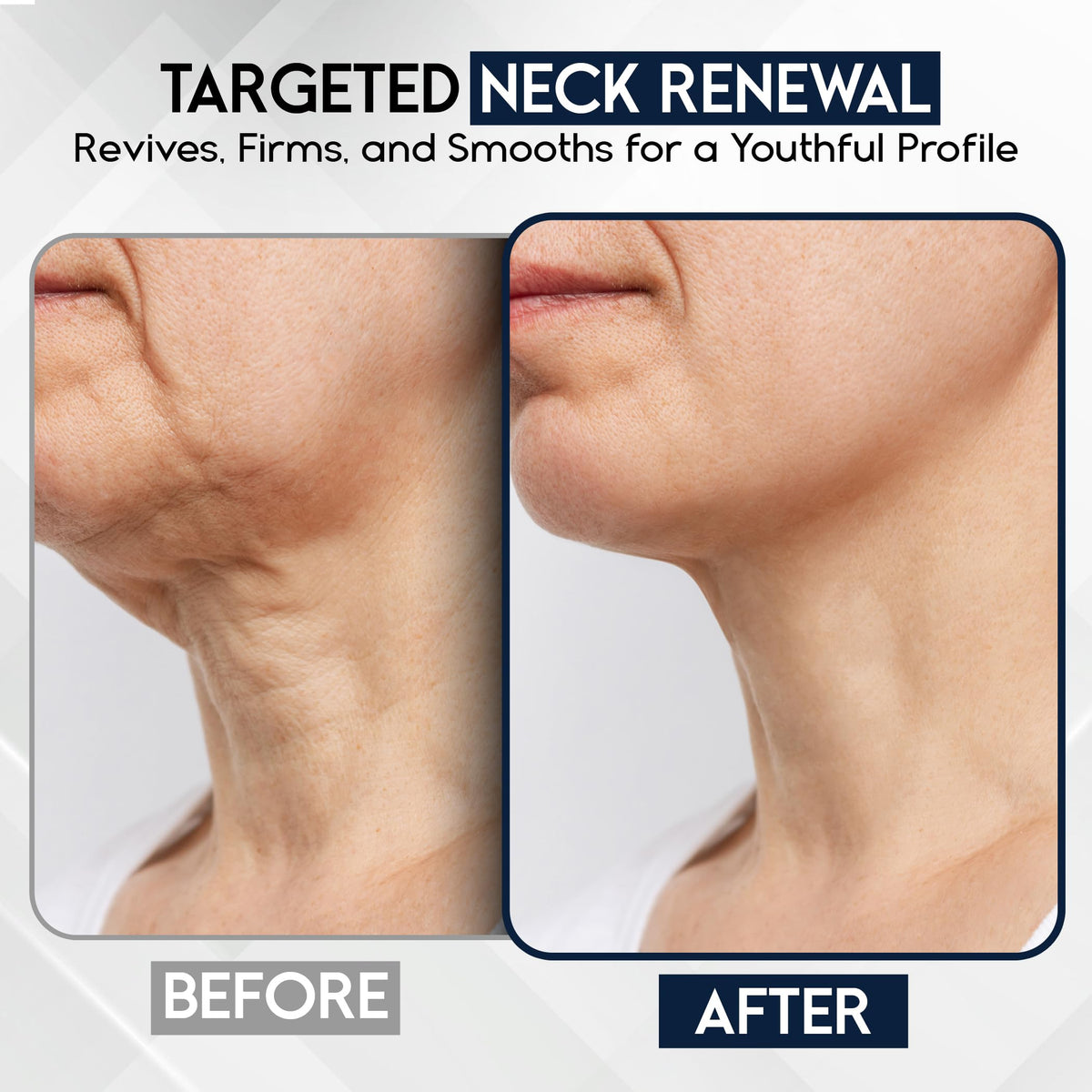 Pharmlitalia neck cream on decollete area for gentle tightening.