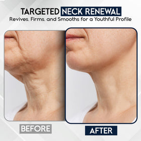 Pharmlitalia neck cream on decollete area for gentle tightening.
