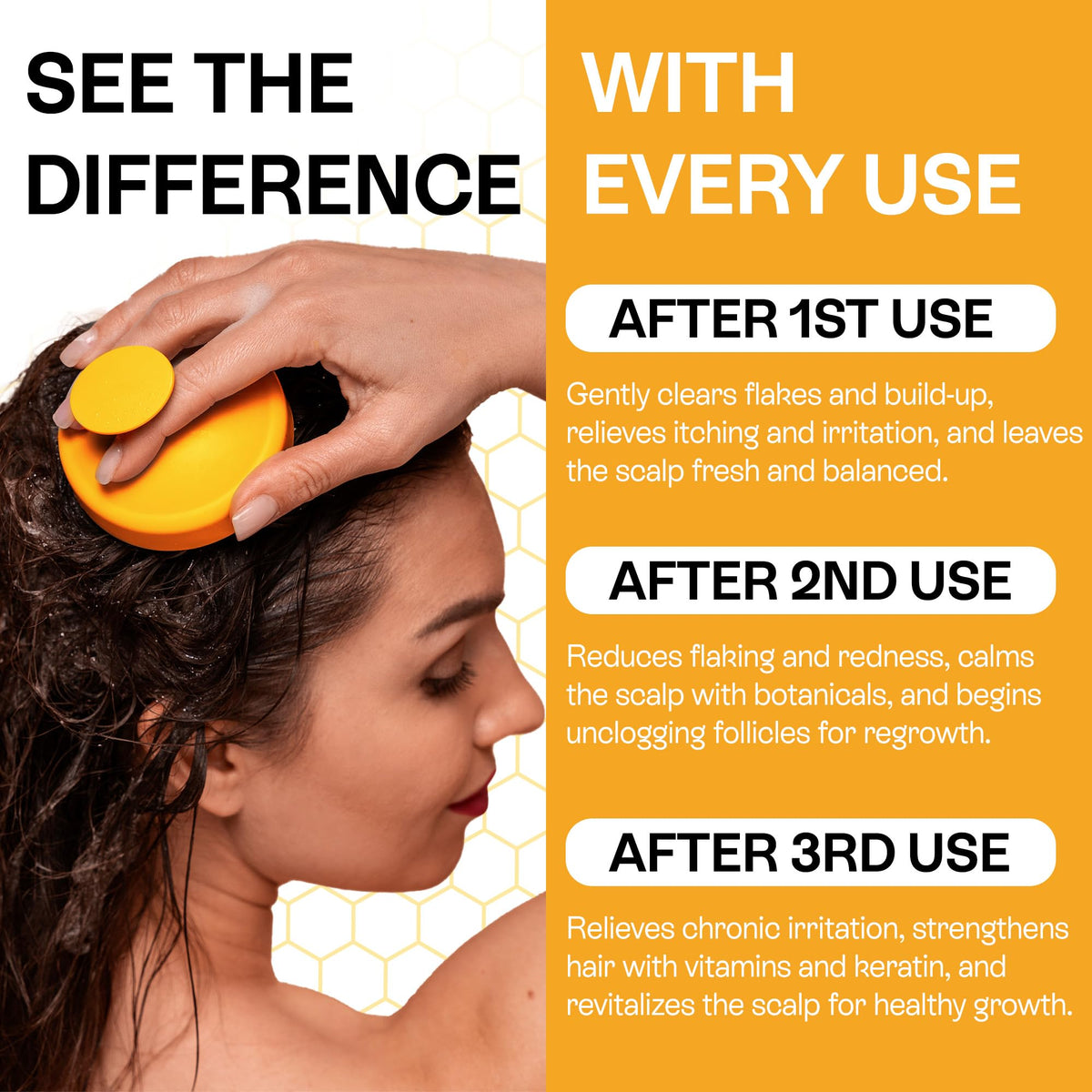 Pharmlitalia psoriasis shampoo pour action for easy scalp care.
