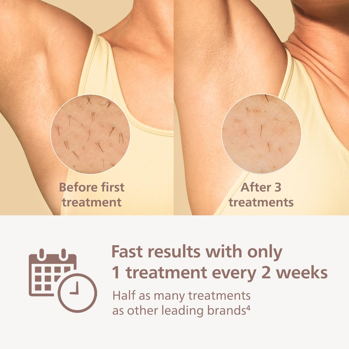 Philips Lumea 8000 app interface with reminders and tips