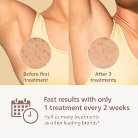 Philips Lumea 8000 app interface with reminders and tips