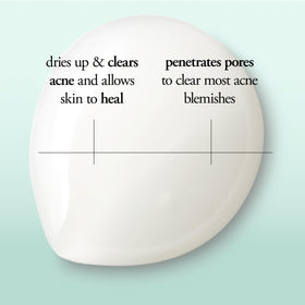 Philosophy Clear Days Ahead gel texture close-up for blemish care.