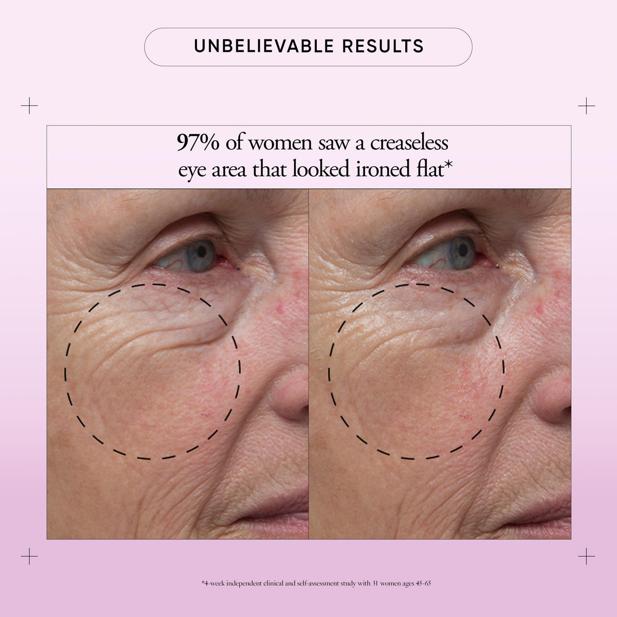 Philosophy clinical study eye cream results graphic summarizes crepiness and hollowness reductions.