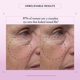 Philosophy clinical study eye cream results graphic summarizes crepiness and hollowness reductions.