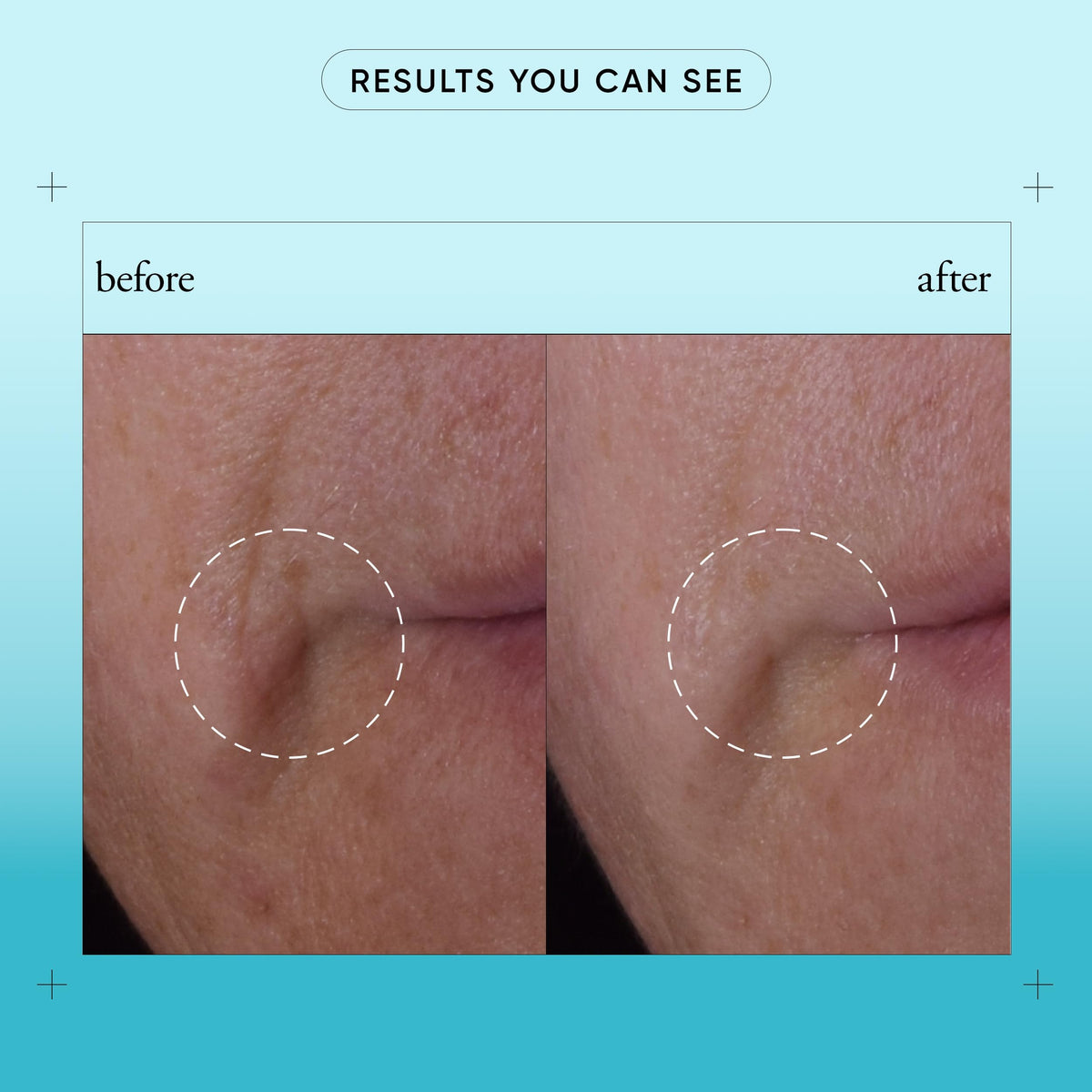 philosophy Dose of Wisdom serum pump application demonstrates easy daily delivery