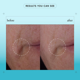 philosophy Dose of Wisdom serum pump application demonstrates easy daily delivery