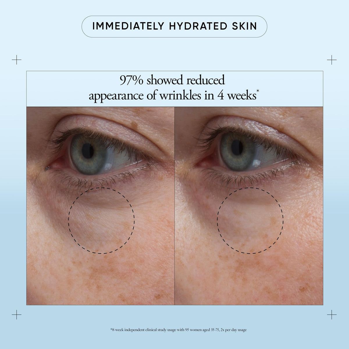 Philosophy eye revival serum application on fingertip showing blend