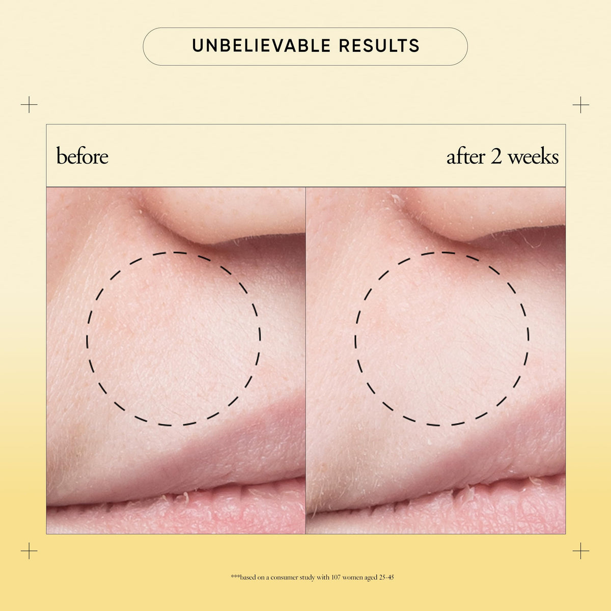 philosophy purity made simple pore extractor mask after-use close-up shows refreshed, clean skin