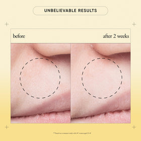 philosophy purity made simple pore extractor mask after-use close-up shows refreshed, clean skin