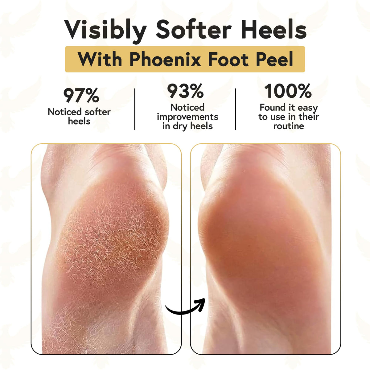 Phoenix Foot Peel shea butter application on skin demonstrates intense hydration.