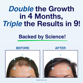 Phyllotex herbal formula packaging emphasizing natural hair support