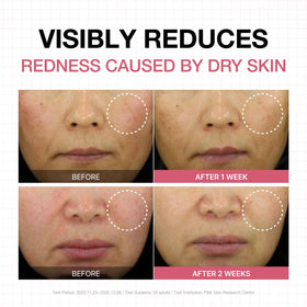 PHYSIOGEL Calming Relief Lotion on skin demonstrating redness relief for sensitive skin