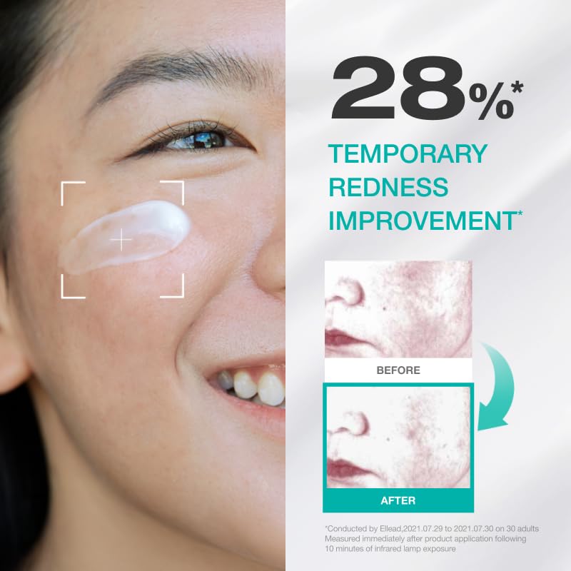 Physiogel Red Soothing Cica Balance Cream application on the cheek for redness management.