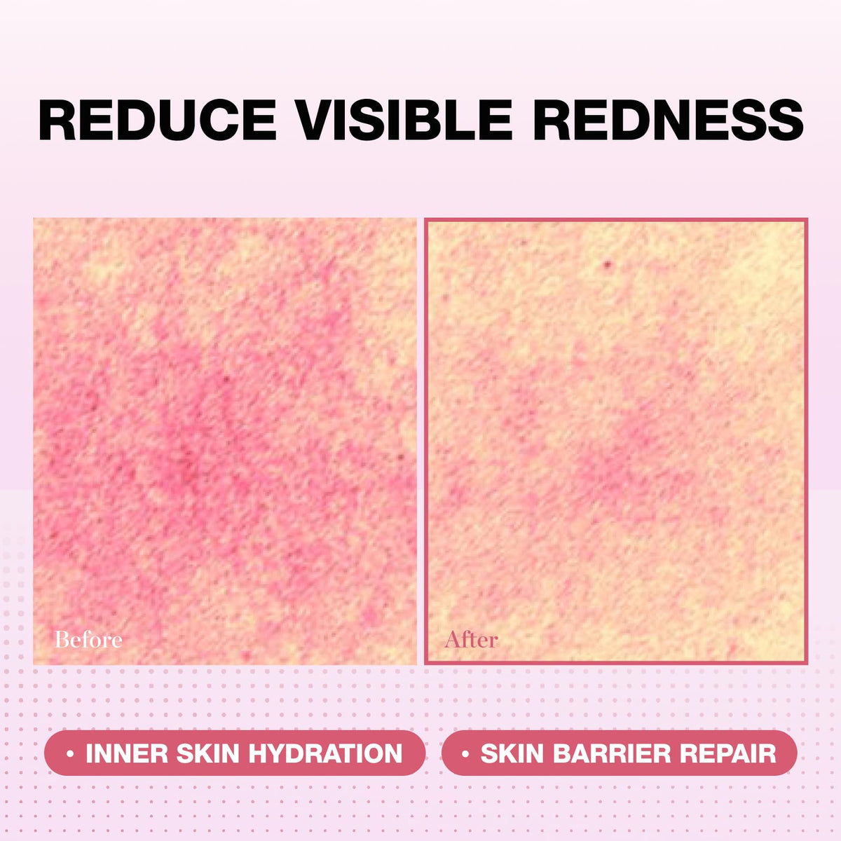 Physiogel Red Soothing Essence cream texture ideal for dry and sensitive skin