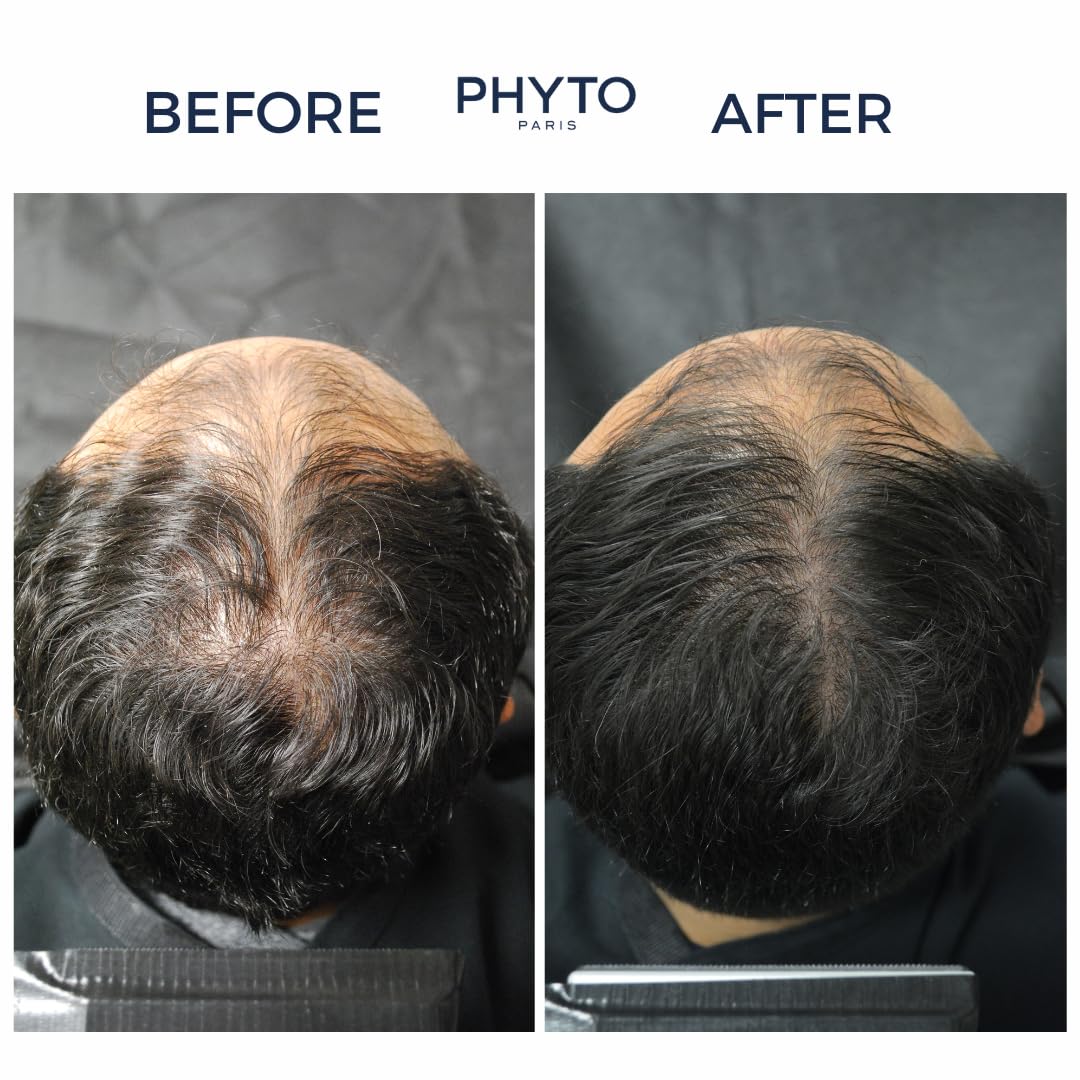 PHYTOCYANE before-after hints density and texture improvement.