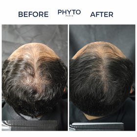 PHYTOCYANE before-after hints density and texture improvement.