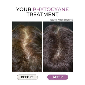 PHYTOCYANE capsule closeup highlighting daily hair support.