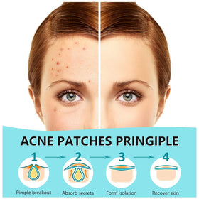 PICcircuit face patch close-up applying on skin for quick zit care.