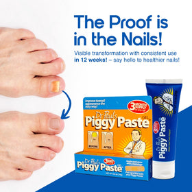 Piggy Paste yellow nails improvement highlights discoloration reduction.