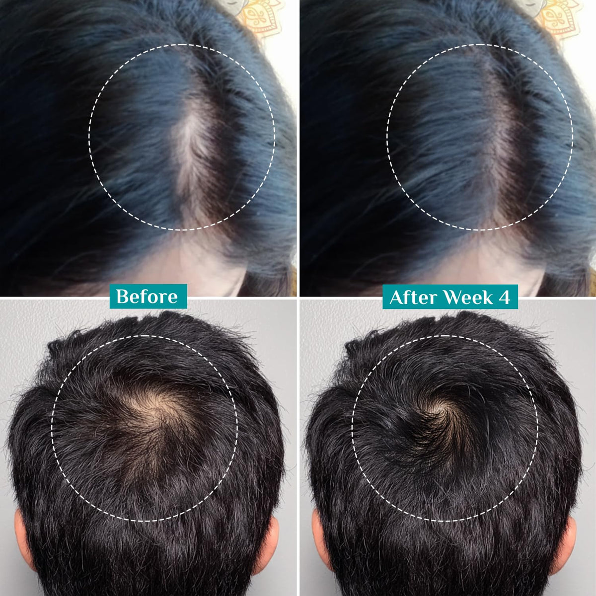 Pilgrim Advanced Hair Growth Serum scalp application shows quick, non-greasy daily use