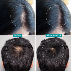 Pilgrim Advanced Hair Growth Serum scalp application shows quick, non-greasy daily use