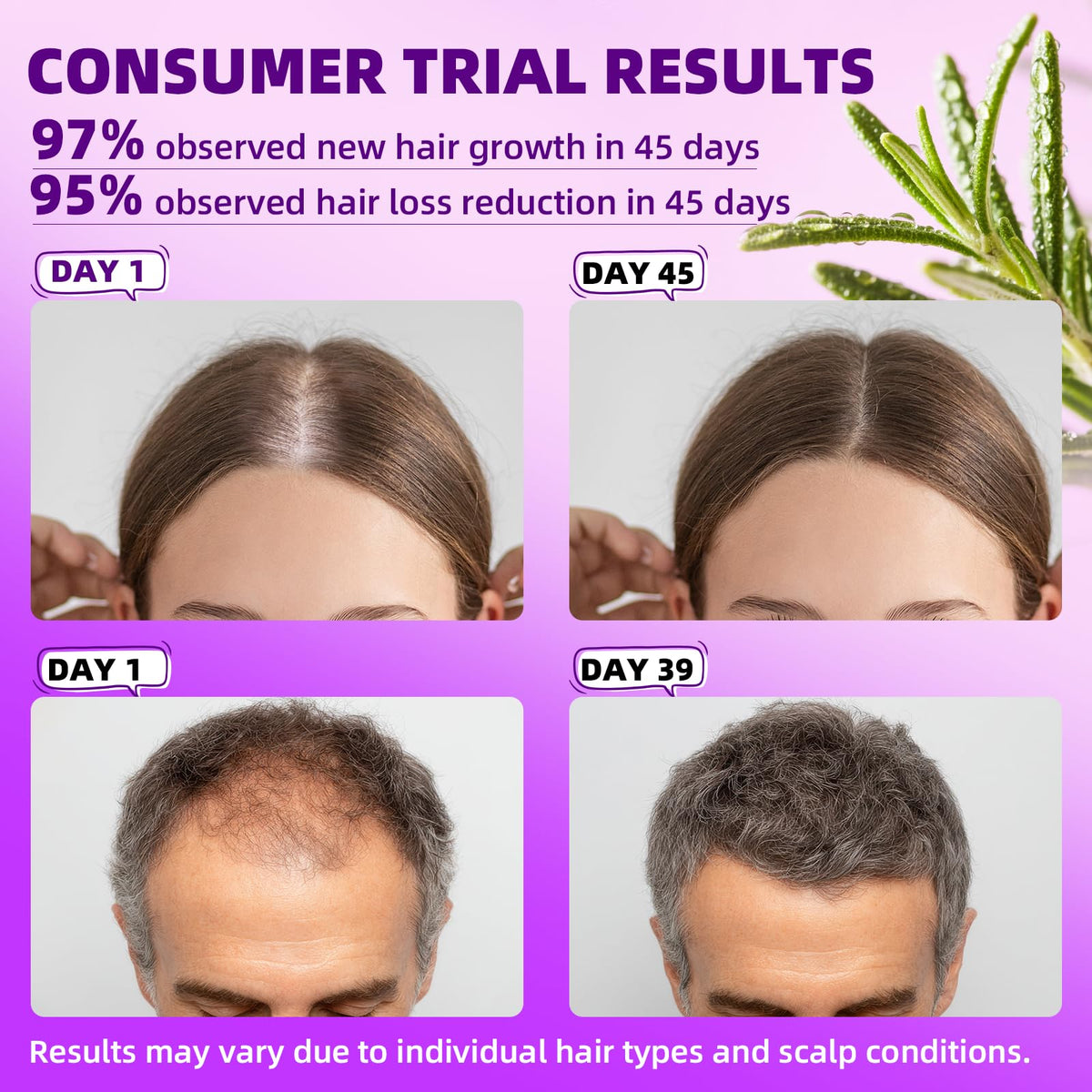 Pipuxi minoxidil application area on the scalp for targeted spray.