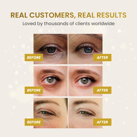 PLANTIFIQUE 24K Gold Eye Patches close-up of silky gel texture
