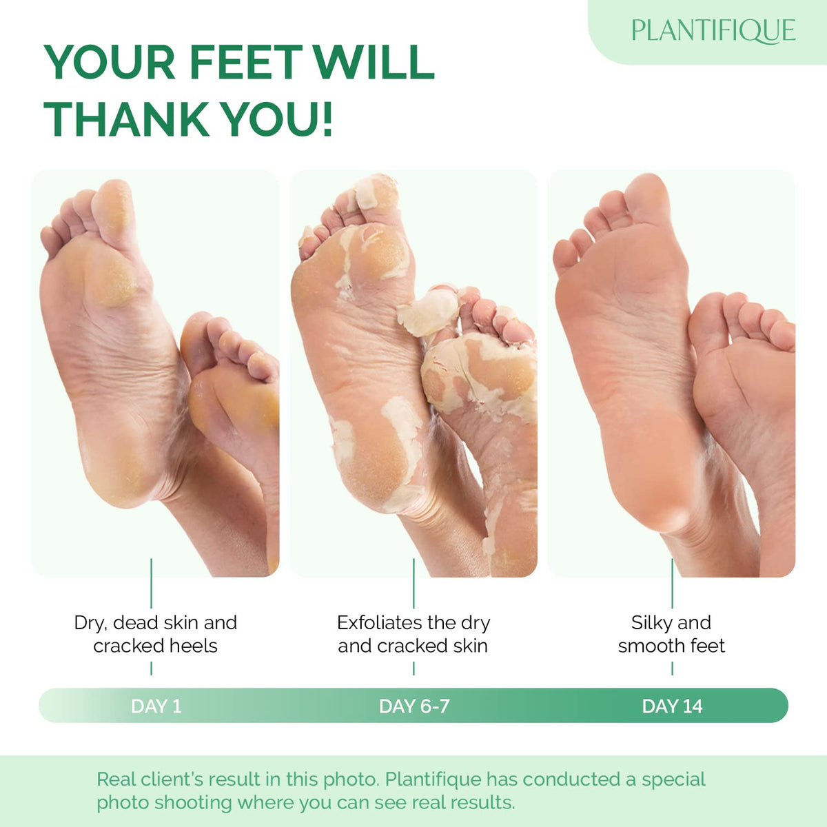 Plantifique derma-tested foot mask ensures safe, comfortable use on cracked feet.