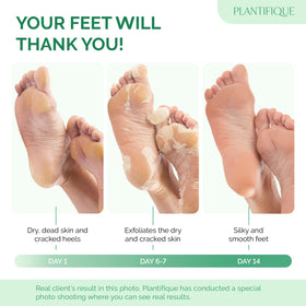 Plantifique derma-tested foot mask ensures safe, comfortable use on cracked feet.