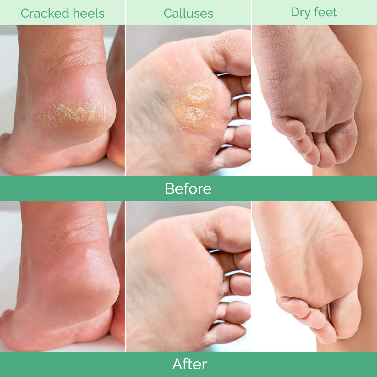 Plantifique peach kernel oil nourishes and hydrates during the peel.