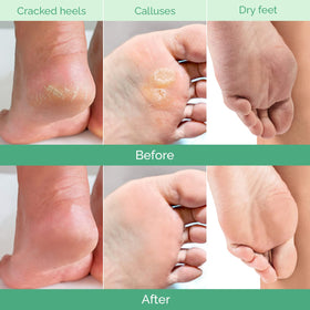 Plantifique peach kernel oil nourishes and hydrates during the peel.