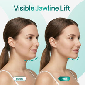 PLANTIFIQUE V-Line mask worn for comfortable daily use
