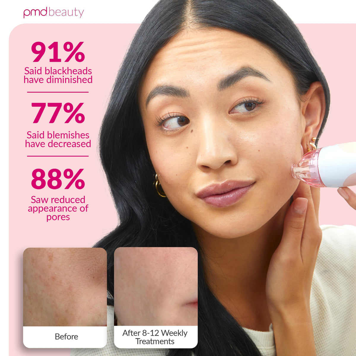 PMD Beauty Personal Microderm Classic hands-on use in a bathroom setting