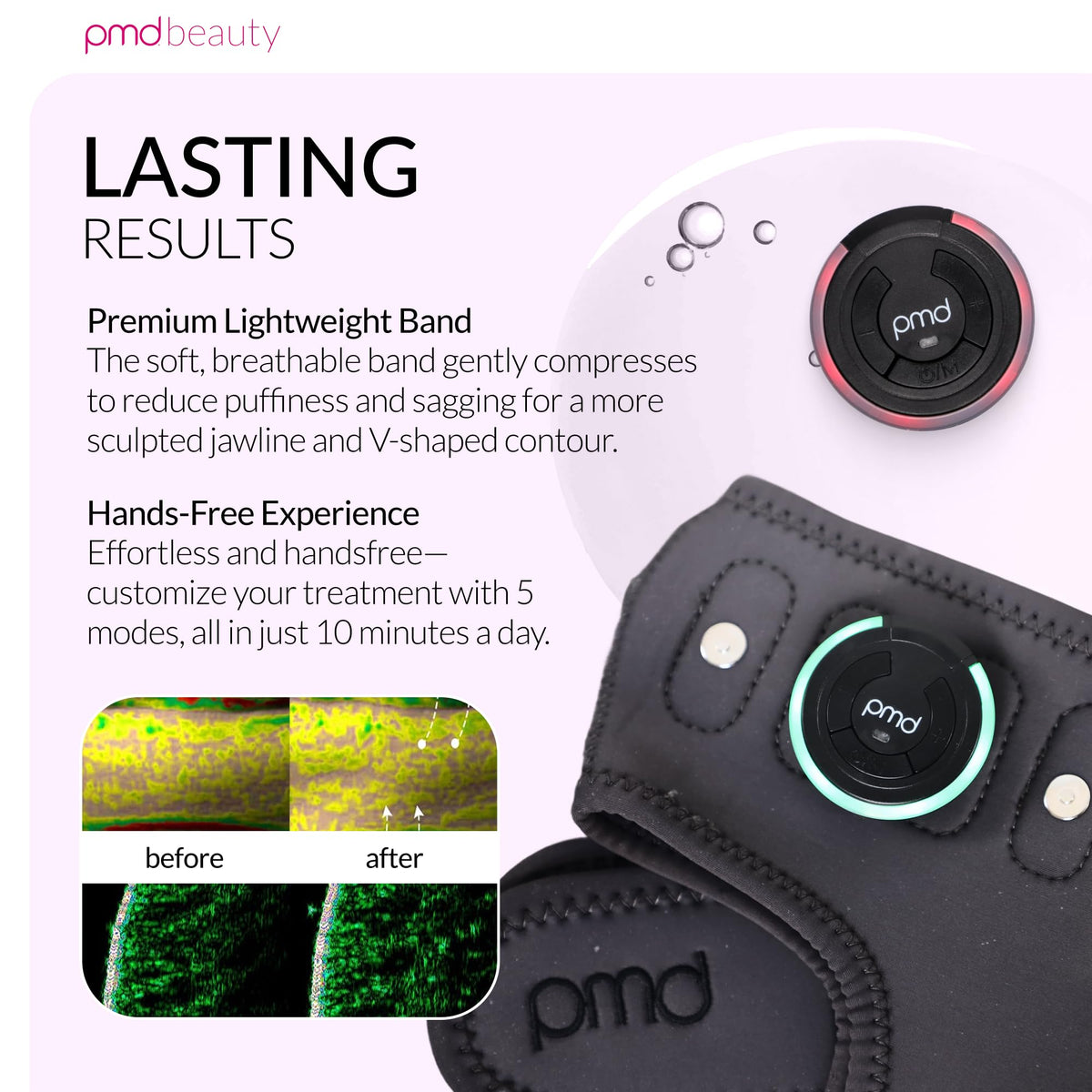 PMD Beauty SMAS Band firming effect adds tension and improved skin feel.