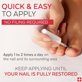 Poderm Toenail Integral Renewal on yellowed nails shows noticeable improvement.