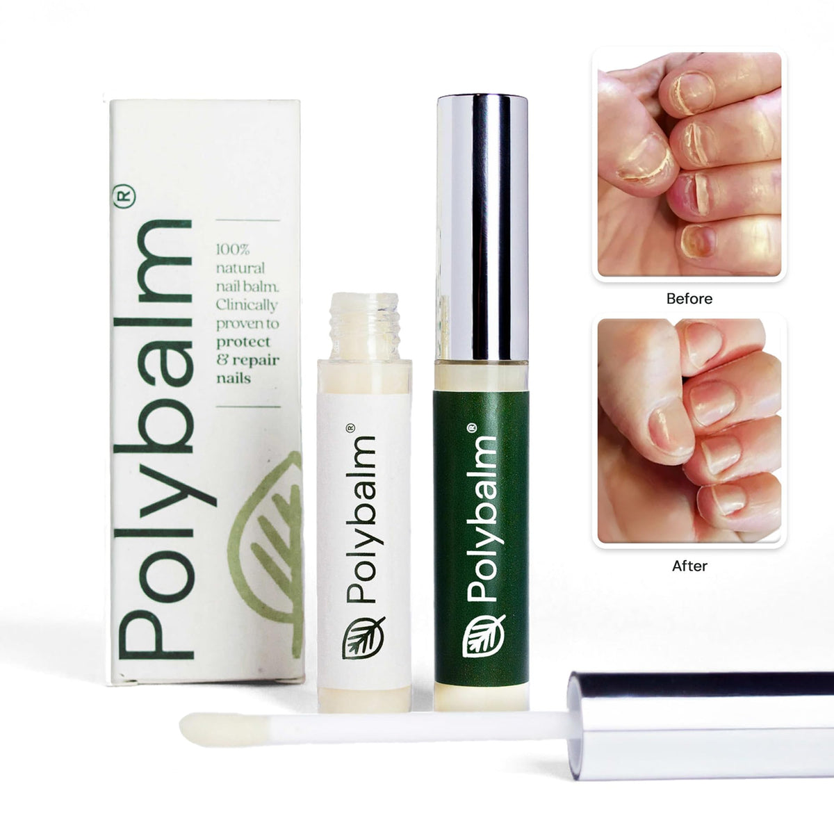 Polybalm Oncology Nail Routine: designed for use before, during, after treatment.