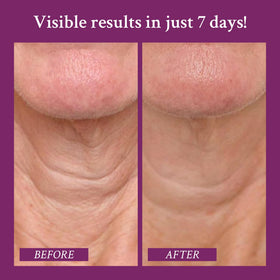 PRAI SEPILIFT-technology close-up suggests firming lift.