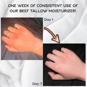 Primal Basics face application tallow balm on hand demonstrates easy absorption.