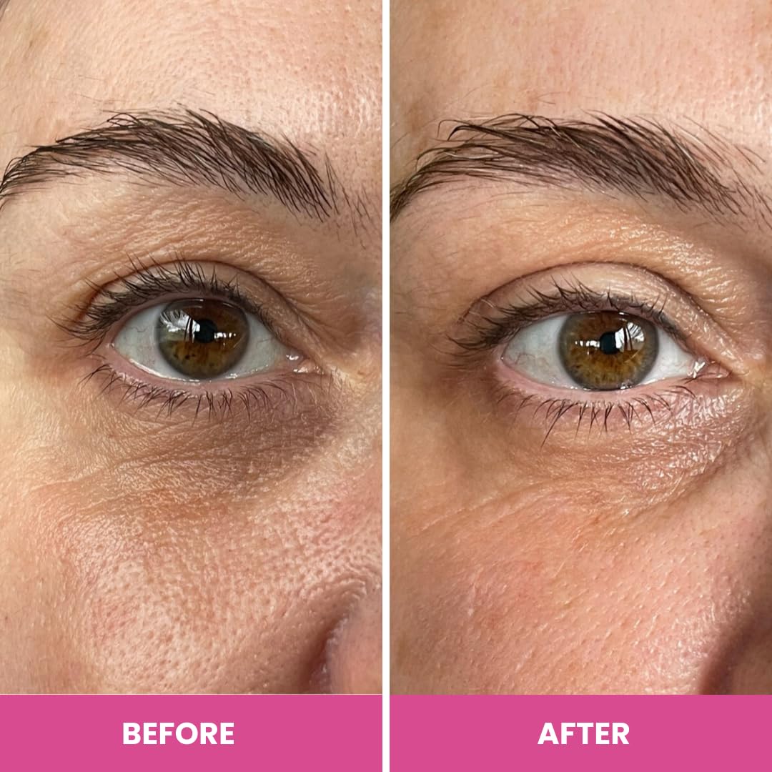 Prime Prometics PrimeEyes Hydrate focuses on mature skin concerns around the eye.