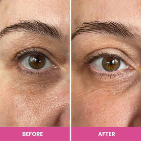 Prime Prometics PrimeEyes Hydrate focuses on mature skin concerns around the eye.