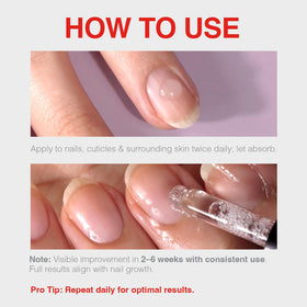 Probelle Nail Discomfort Relief image suggesting soothing comfort for nails.