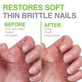 Probelle Nail Hardener Formula 1 base top coat versatility in routine