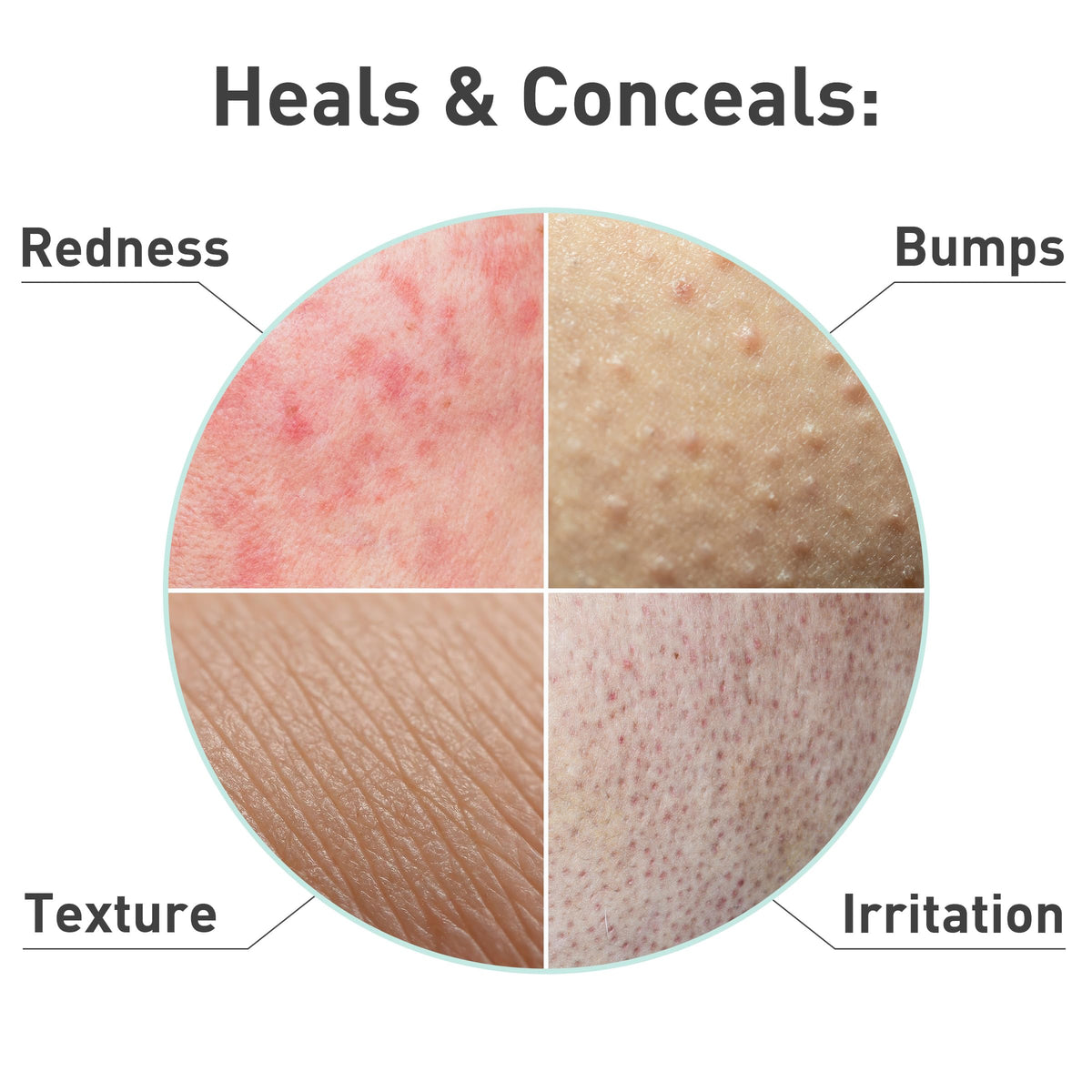 Application on cheek highlights gentle, non-greasy hydration for sensitive skin.
