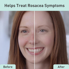 Close-up of Rosacare serum texture shows lightweight, fast-absorbing formula.