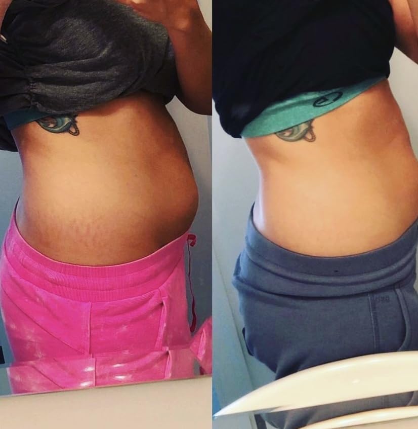 Promise Prenatal Belly Butter applied to skin with quick absorption