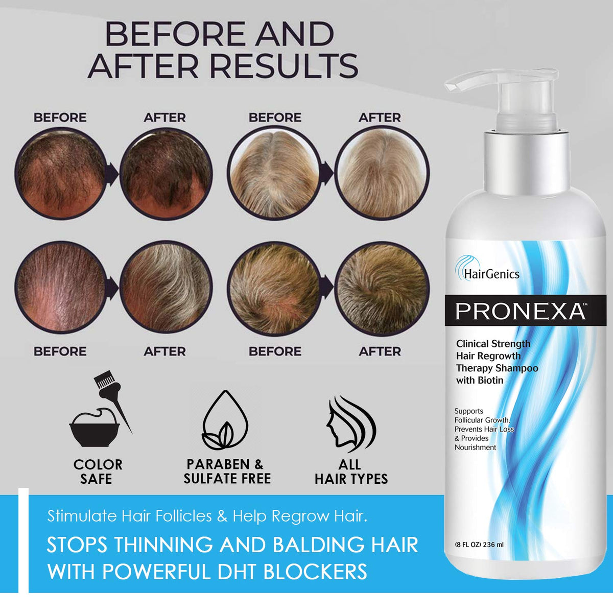 Pronexa shampoo on scalp illustration signals nourishing scalp vitality.