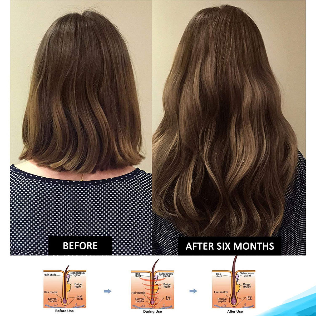 Pronexa Hairgenics bottle packaging emphasizes purity and potency.