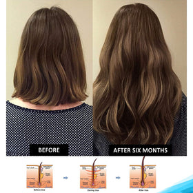 Pronexa Hairgenics bottle packaging emphasizes purity and potency.