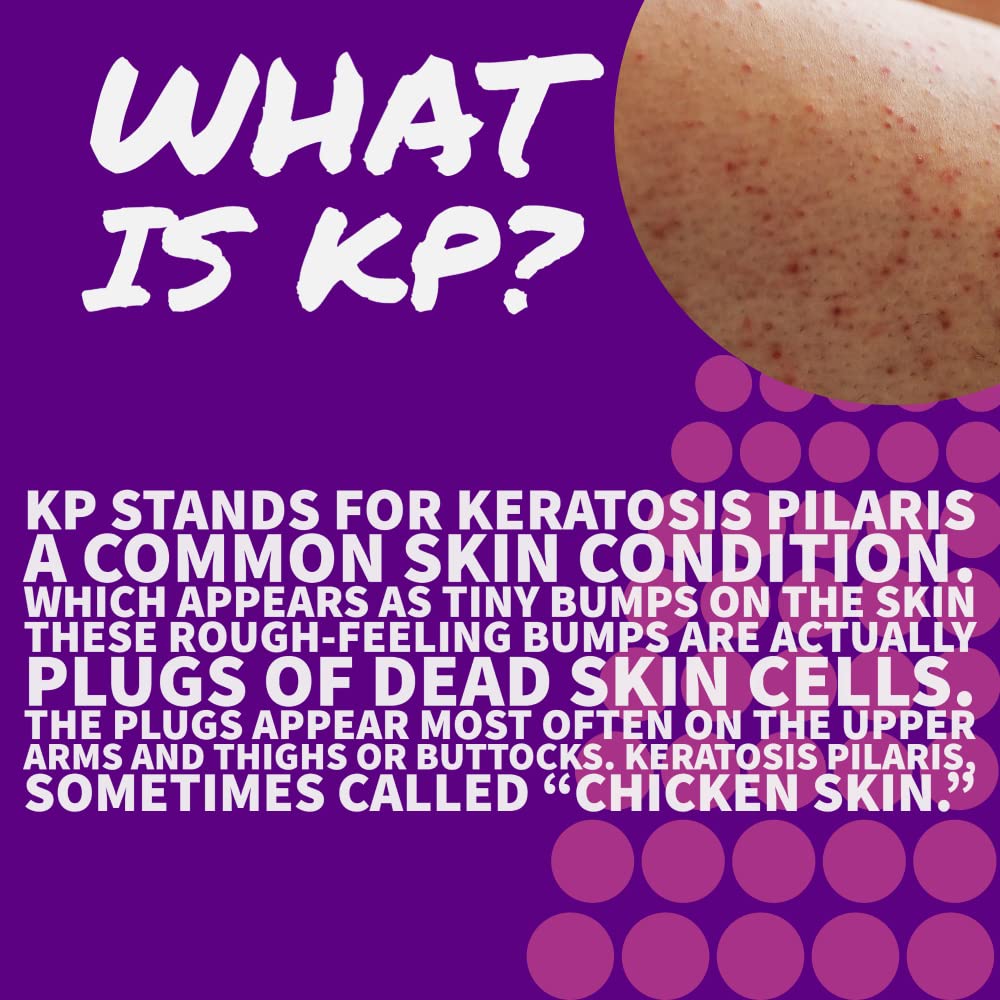 Pruderma KP lotion texture on skin close-up showing even absorption.