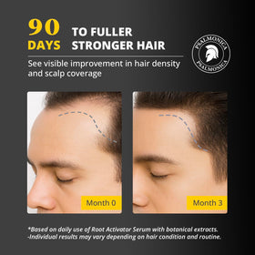 Psalmonica Root Activator serum applied to scalp showing quick absorption